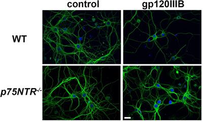 Reversal of Cognitive Impairment in gp120 Transgenic Mice by the Removal of the p75 Neurotrophin Receptor